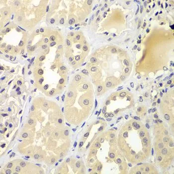 IHC-P analysis of human kidney tissue using GTX32945 UBE2Z antibody. Dilution : 1:100