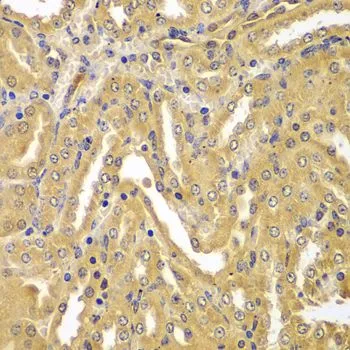 IHC-P analysis of mouse kidney tissue using GTX32945 UBE2Z antibody. Dilution : 1:100