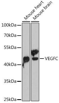 WB analysis of various sample lysates using GTX32962 VEGFC antibody. Dilution : 1:1000 Loading : 25microg per lane WB analysis of various sample lysates using GTX32962 VEGFC antibody. Dilution : 1:1000 Loading : 25microg per lane