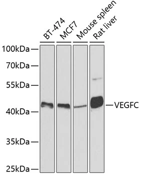 WB analysis of various sample lysates using GTX32962 VEGFC antibody. Dilution : 1:500 Loading : 25microg per lane