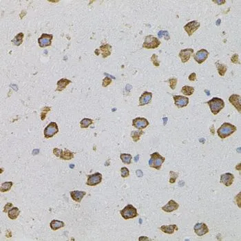 IHC-P analysis of mouse brain tissue using GTX32962 VEGFC antibody.