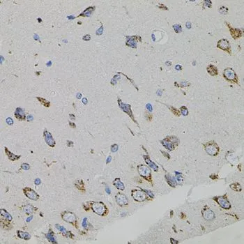 IHC-P analysis of rat brain tissue using GTX32962 VEGFC antibody.