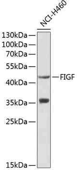 WB analysis of NCI-H460 cell lysate using GTX32963 VEGFD antibody. Dilution : 1:1000 Loading : 25microg per lane