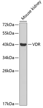 WB analysis of mouse kidney tissue lysate using GTX32967 Vitamin D Receptor antibody. Dilution : 1:1000 Loading : 25microg per lane WB analysis of mouse kidney tissue lysate using GTX32967 Vitamin D Receptor antibody. Dilution : 1:1000 Loading : 25microg per lane