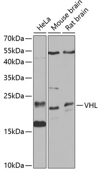 WB analysis of various sample lysates using GTX32968 Von Hippel Lindau antibody. Dilution : 1:1000 Loading : 25microg per lane WB analysis of various sample lysates using GTX32968 Von Hippel Lindau antibody. Dilution : 1:1000 Loading : 25microg per lane