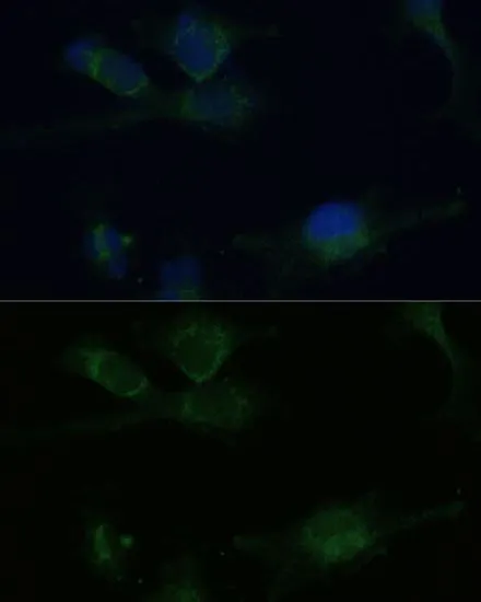ICC/IF analysis of U-251 MG cells using GTX32968 Von Hippel Lindau antibody. Blue : DAPI Dilution : 1:100