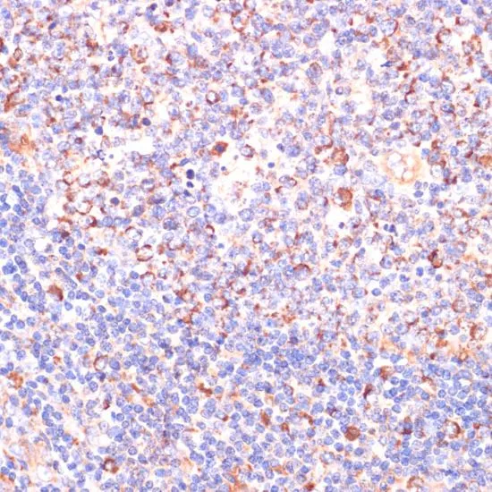 IHC-P analysis of human tonsil tissue using GTX32968 Von Hippel Lindau antibody. Dilution : 1:200