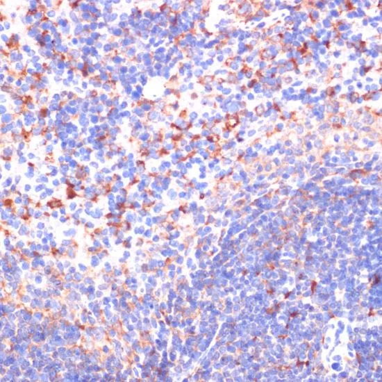 IHC-P analysis of mouse spleen tissue using GTX32968 Von Hippel Lindau antibody. Dilution : 1:200