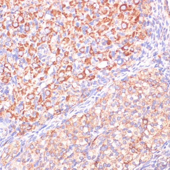 IHC-P analysis of rat ovary tissue using GTX32968 Von Hippel Lindau antibody. Dilution : 1:200