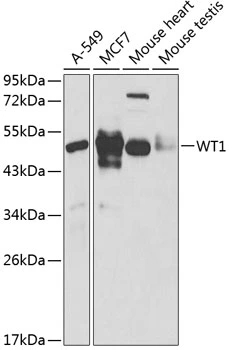 WB analysis of various sample lysates using GTX32972 Wilms Tumor 1 antibody. Dilution : 1:1000 Loading : 25microg per lane WB analysis of various sample lysates using GTX32972 Wilms Tumor 1 antibody. Dilution : 1:1000 Loading : 25microg per lane