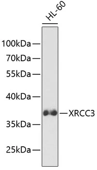 WB analysis of HL-60 cell lysate using GTX32975 XRCC3 antibody. Dilution : 1:1000 Loading : 25microg per lane WB analysis of HL-60 cell lysate using GTX32975 XRCC3 antibody. Dilution : 1:1000 Loading : 25microg per lane