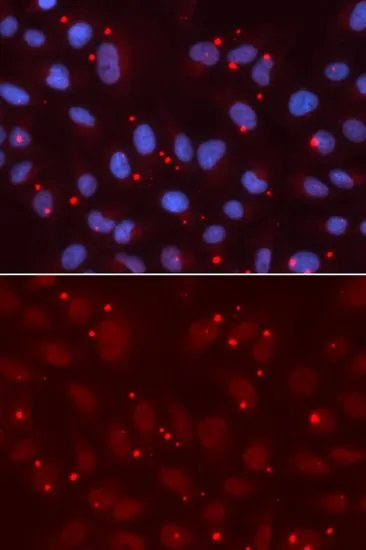 ICC/IF analysis of U2OS cells using GTX32975 XRCC3 antibody. Blue : DAPI