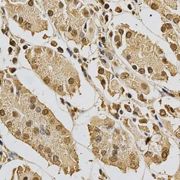 IHC-P analysis of human stomach tissue using GTX32975 XRCC3 antibody. Dilution : 1:200