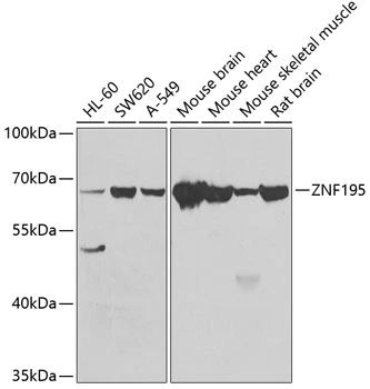 WB analysis of various sample lysates using GTX32980 ZNF195 antibody. Dilution : 1:1000 Loading : 25microg per lane WB analysis of various sample lysates using GTX32980 ZNF195 antibody. Dilution : 1:1000 Loading : 25microg per lane