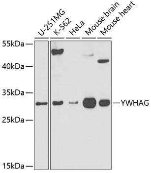 WB analysis of various sample lysates using GTX32982 14-3-3 gamma antibody. Dilution : 1:500 Loading : 25microg per lane WB analysis of various sample lysates using GTX32982 14-3-3 gamma antibody. Dilution : 1:500 Loading : 25microg per lane