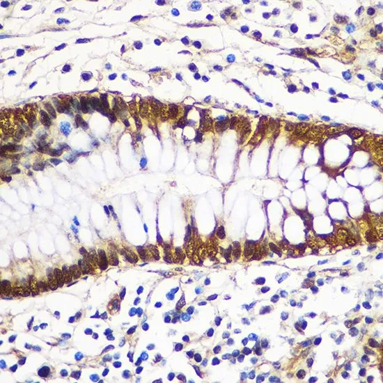 IHC-P analysis of human colon tissue using GTX32982 14-3-3 gamma antibody. Dilution : 1:100
