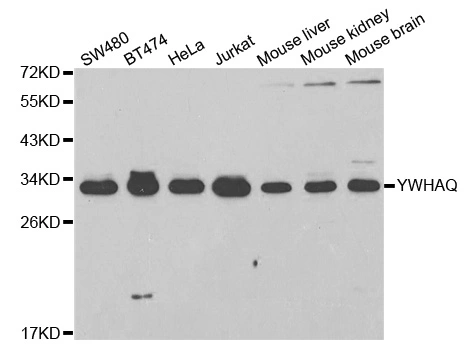 WB analysis of various sample lysates using GTX32983 14-3-3 theta antibody. Dilution : 1:1000 Loading : 25microg per lane WB analysis of various sample lysates using GTX32983 14-3-3 theta antibody. Dilution : 1:1000 Loading : 25microg per lane