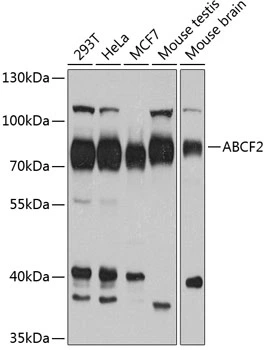 WB analysis of various sample lysates using GTX32985 ABCF2 antibody. Dilution : 1:1000 Loading : 25microg per lane WB analysis of various sample lysates using GTX32985 ABCF2 antibody. Dilution : 1:1000 Loading : 25microg per lane
