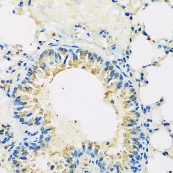 IHC-P analysis of mouse lung tissue using GTX32985 ABCF2 antibody. Dilution : 1:100