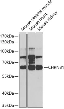 WB analysis of various sample lysates using GTX32988 AChR beta 1 antibody. Dilution : 1:1000 Loading : 25microg per lane