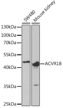 WB analysis of various sample lysates using GTX32991 Activin Receptor Type IB antibody. Dilution : 1:1000 Loading : 25microg per lane WB analysis of various sample lysates using GTX32991 Activin Receptor Type IB antibody. Dilution : 1:1000 Loading : 25microg per lane