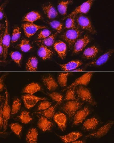 ICC/IF analysis of HeLa cells using GTX32998 ALDH1B1 antibody. Blue : DAPI Dilution : 1:100