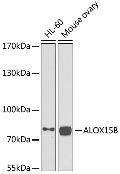WB analysis of various sample lysates using GTX33001 ALOX15B antibody. Dilution : 1:1000 Loading : 25microg per lane WB analysis of various sample lysates using GTX33001 ALOX15B antibody. Dilution : 1:1000 Loading : 25microg per lane