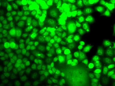 ICC/IF analysis of MCF7 cells using GTX33001 ALOX15B antibody.