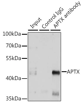 IP analysis of A549 cell lysate using GTX33016 Aprataxin antibody. Antibody amount : 3microg / 150microg lysate Dilution : 1:500 IP analysis of A549 cell lysate using GTX33016 Aprataxin antibody. Antibody amount : 3microg / 150microg lysate Dilution : 1:500