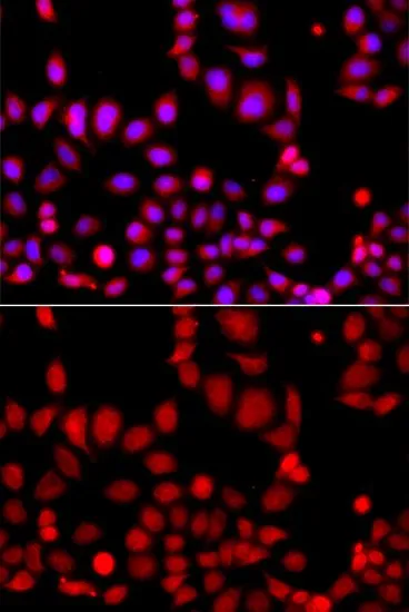 ICC/IF analysis of A549 cells using GTX33018 ARHGEF9 antibody. Blue : DAPI