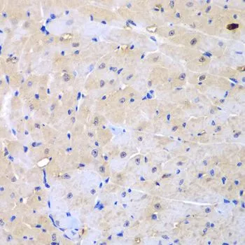IHC-P analysis of mouse heart tissue using GTX33018 ARHGEF9 antibody. Dilution : 1:100