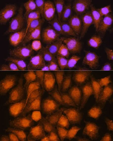 ICC/IF analysis of HeLa cells using GTX33022 ASNA1 antibody. Blue : DAPI Dilution : 1:100