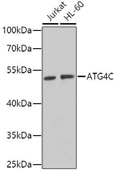 WB analysis of various sample lysates using GTX33024 ATG4C antibody. Dilution : 1:1000 Loading : 25microg per lane WB analysis of various sample lysates using GTX33024 ATG4C antibody. Dilution : 1:1000 Loading : 25microg per lane