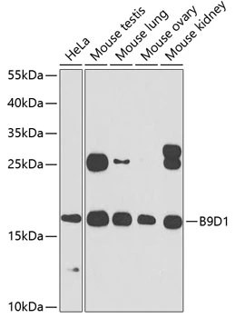WB analysis of various sample lysates using GTX33030 B9D1 antibody. Dilution : 1:1000 Loading : 25microg per lane WB analysis of various sample lysates using GTX33030 B9D1 antibody. Dilution : 1:1000 Loading : 25microg per lane