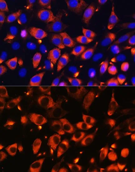 ICC/IF analysis of L929 cells using GTX33030 B9D1 antibody. Blue : DAPI Dilution : 1:100