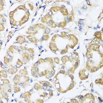 IHC-P analysis of human stomach tissue using GTX33030 B9D1 antibody. Dilution : 1:100
