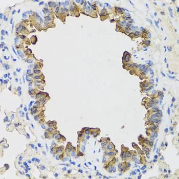 IHC-P analysis of mouse lung tissue using GTX33030 B9D1 antibody. Dilution : 1:100