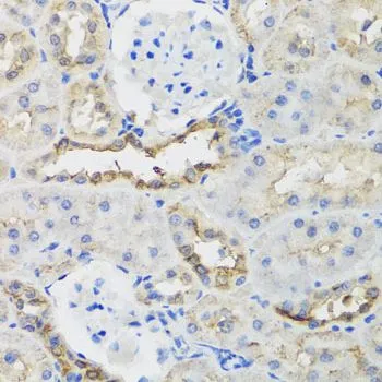 IHC-P analysis of rat kidney tissue using GTX33030 B9D1 antibody. Dilution : 1:100