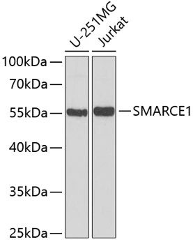 WB analysis of various sample lysates using GTX33031 BAF57 antibody. Dilution : 1:1000 Loading : 25microg per lane WB analysis of various sample lysates using GTX33031 BAF57 antibody. Dilution : 1:1000 Loading : 25microg per lane