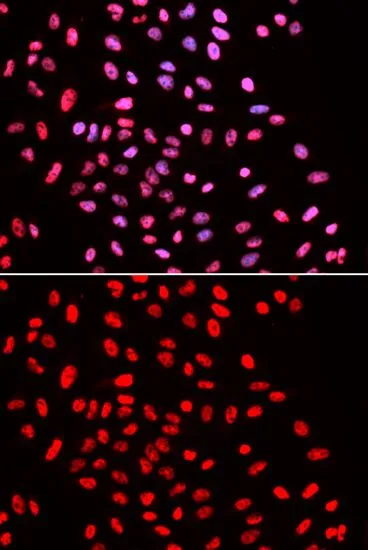 ICC/IF analysis of U2OS cells using GTX33031 BAF57 antibody. Blue : DAPI