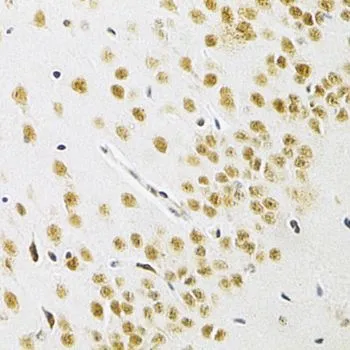 IHC-P analysis of mouse brain tissue using GTX33031 BAF57 antibody. Dilution : 1:200