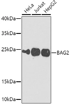WB analysis of various sample lysates using GTX33033 BAG2 antibody. The signal was developed with ECL plus-Enhanced. Dilution : 1:1000 Loading : 25microg per lane WB analysis of various sample lysates using GTX33033 BAG2 antibody. The signal was developed with ECL plus-Enhanced. Dilution : 1:1000 Loading : 25microg per lane