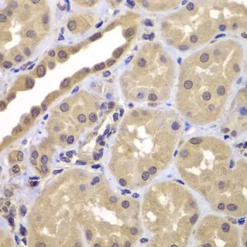 IHC-P analysis of human kidney tissue using GTX33033 BAG2 antibody. Dilution : 1:100