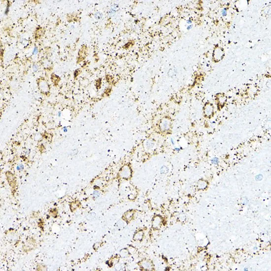 IHC-P analysis of rat brain tissue using GTX33036 BCAT2 antibody. Dilution : 1:100