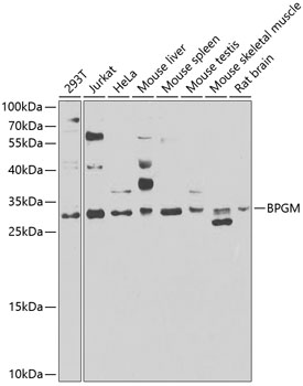 WB analysis of various samples using GTX33041 BPGM antibody. Dilution : 1:1000 Loading : 25ug per lane