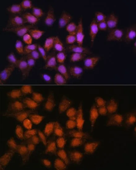 ICC/IF analysis of HeLa cells using GTX33041 BPGM antibody. Blue : DAPI Dilution : 1:100