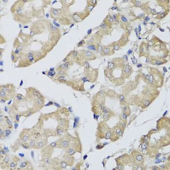 IHC-P analysis of human stomach tissue using GTX33041 BPGM antibody. Dilution : 1:100