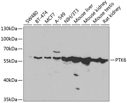 WB analysis of various sample lysates using GTX33043 Brk antibody. Dilution : 1:1000 Loading : 25microg per lane WB analysis of various sample lysates using GTX33043 Brk antibody. Dilution : 1:1000 Loading : 25microg per lane