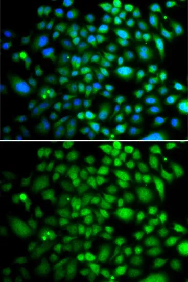 ICC/IF analysis of A549 cells using GTX33043 Brk antibody. Blue : DAPI