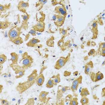 IHC-P analysis of rat brain tissue using GTX33046 BTD antibody. Dilution : 1:100